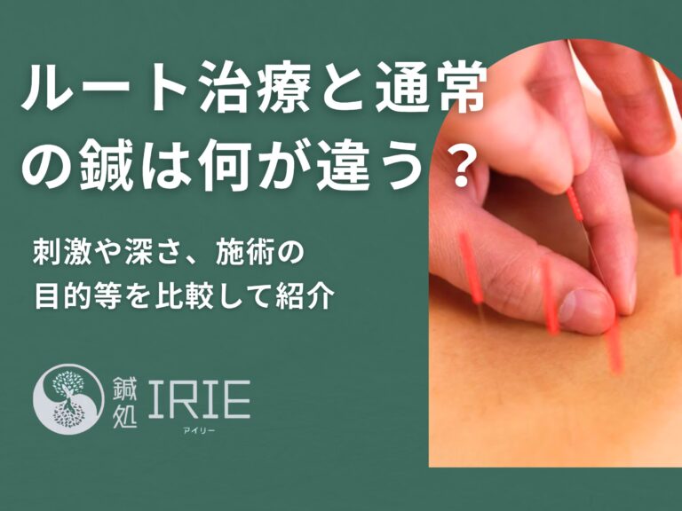 ルート治療と一般的な鍼治療の違いとは？刺激・深さ・目的等を比較して紹介