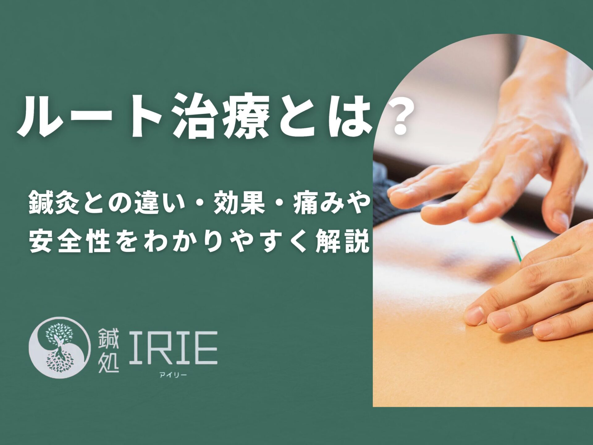 ルート治療とは？鍼灸との違い・効果・痛みや安全性をわかりやすく解説